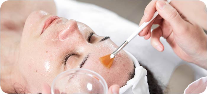 IV Peels in Ocala FL