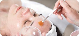 IV Peels in Ocala FL
